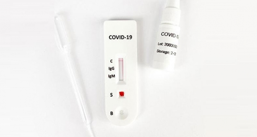 Uzak Doğu'dan ithal edilen antikor test kitlerindeki tehlike