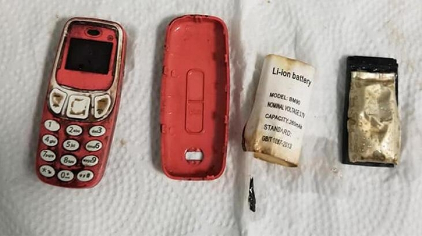 Midesinden üç parça halinde Nokia 3310 çıkardılar