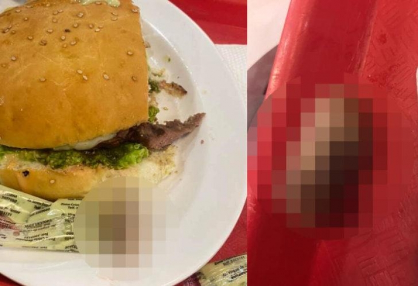 Hamburgerinden insan parmağı çıktı