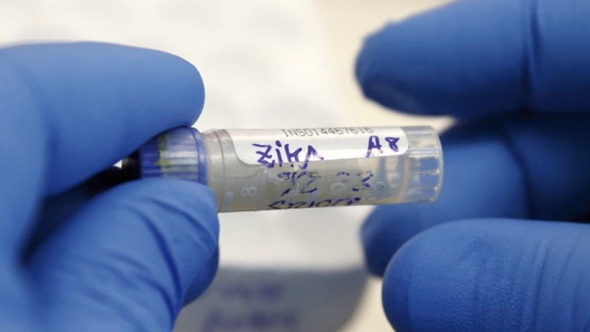 Zika virüsünün DNA dizilimi keşfedildi